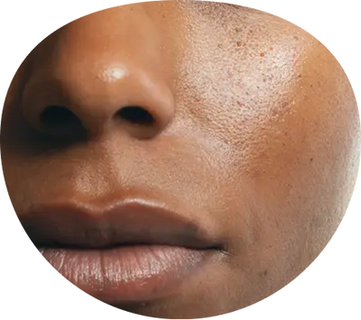 Dull, Tired-Looking Skin